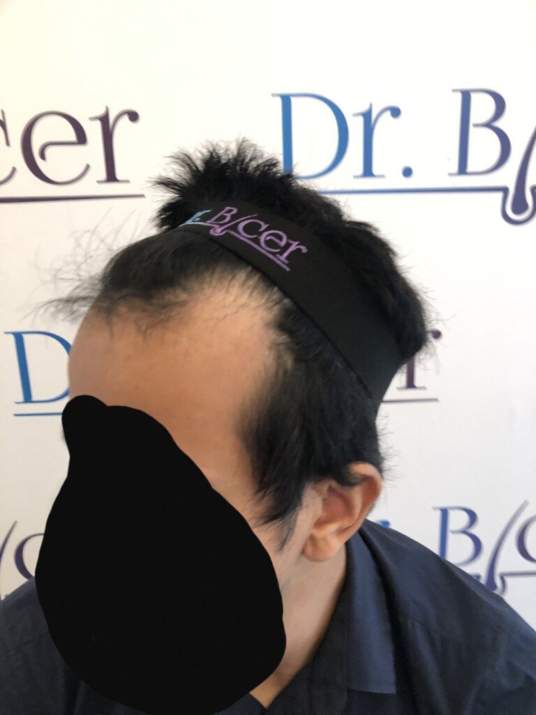 /foren/transplant/index.php/fa/53456/0/