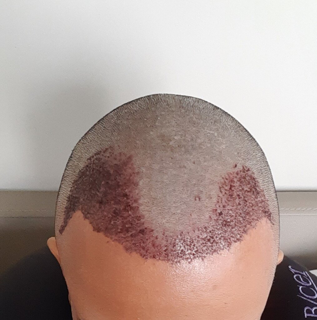 /foren/transplant/index.php/fa/53457/0/