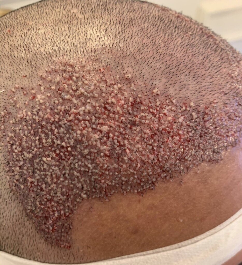 /foren/transplant/index.php/fa/53458/0/