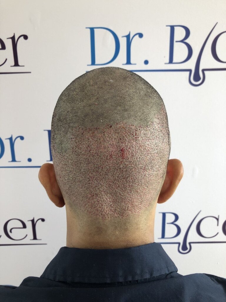 /foren/transplant/index.php/fa/53459/0/