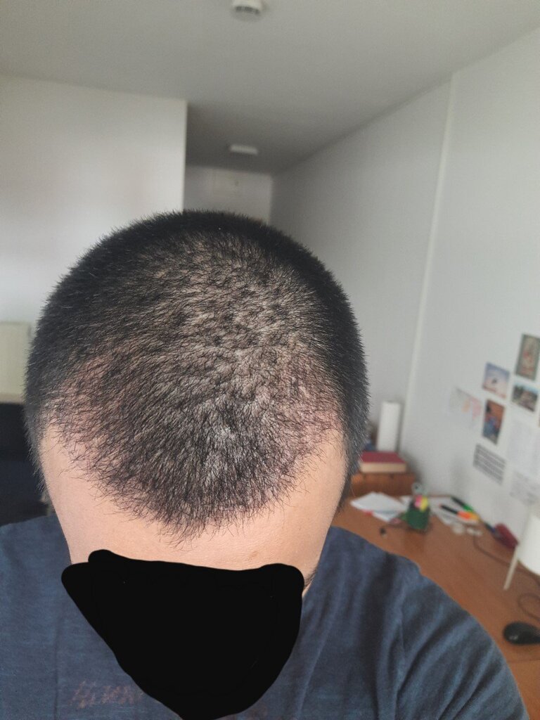 /foren/transplant/index.php/fa/53462/0/