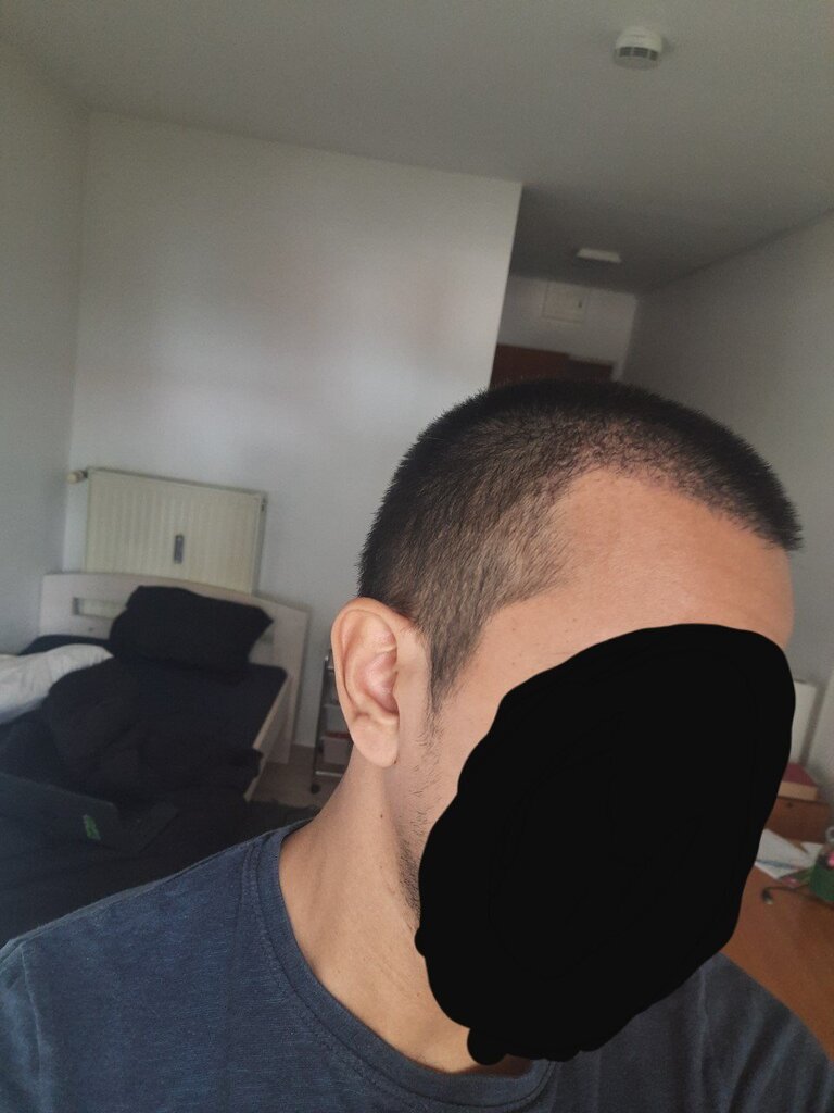 /foren/transplant/index.php/fa/53463/0/