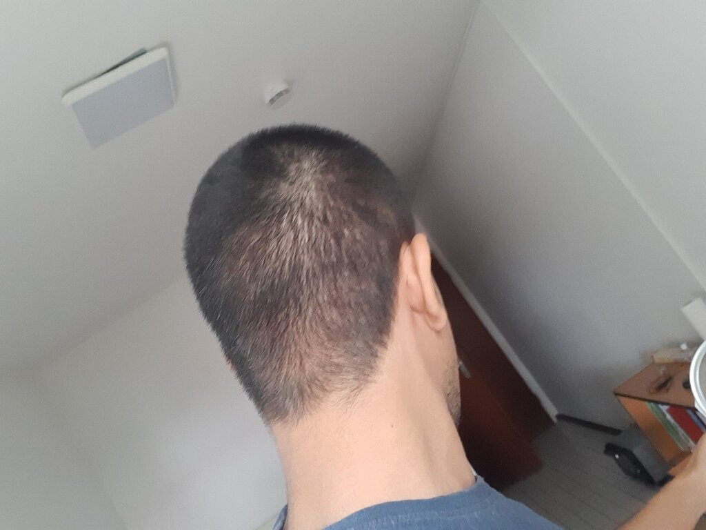 /foren/transplant/index.php/fa/53464/0/