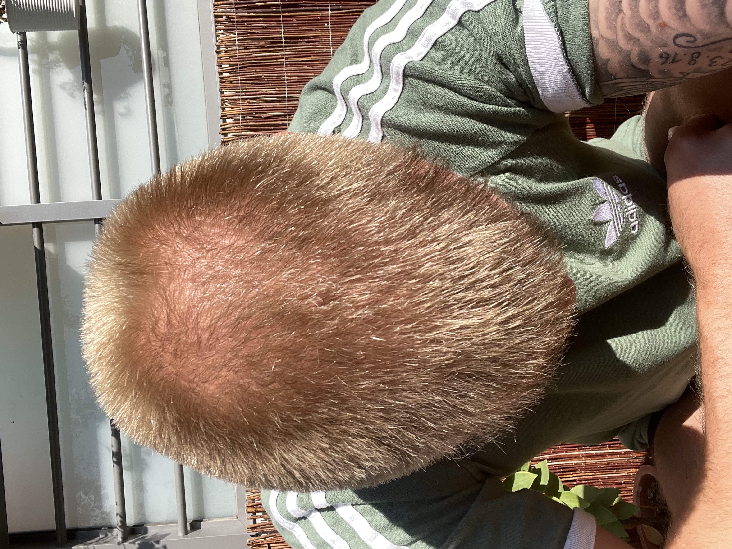 /foren/transplant/index.php/fa/53479/0/