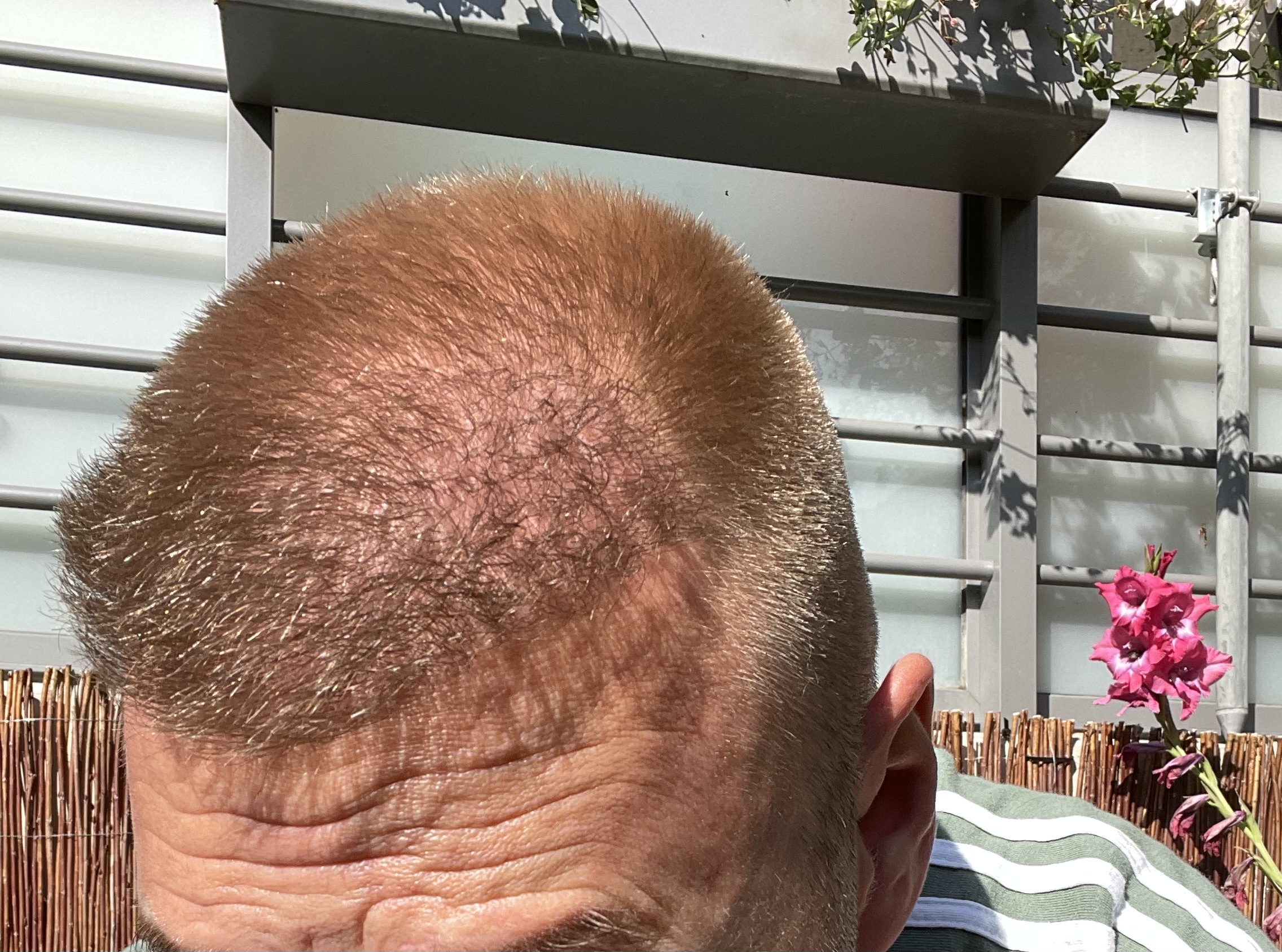 /foren/transplant/index.php/fa/53480/0/