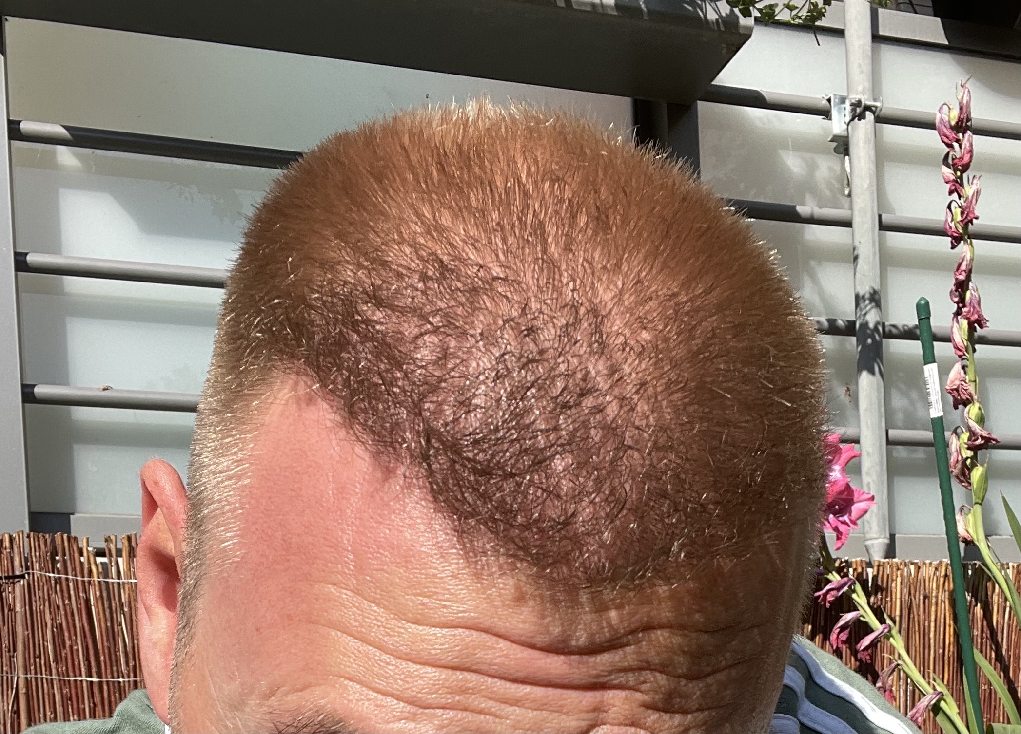 /foren/transplant/index.php/fa/53481/0/