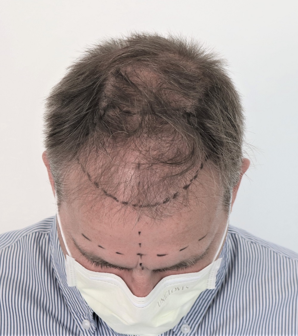 /foren/transplant/index.php/fa/53605/0/