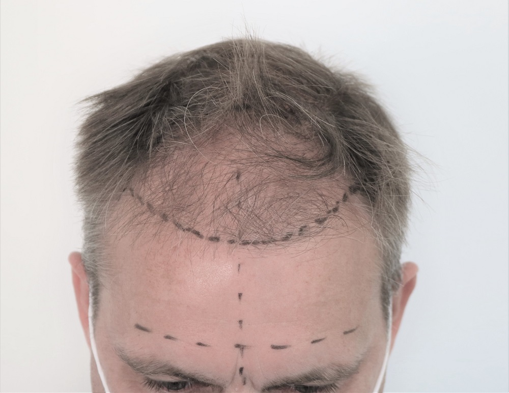 /foren/transplant/index.php/fa/53606/0/