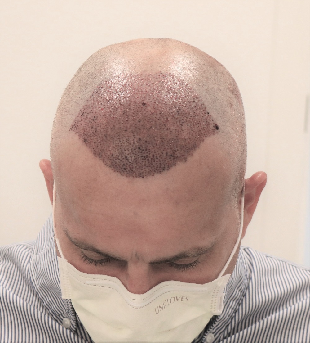 /foren/transplant/index.php/fa/53607/0/