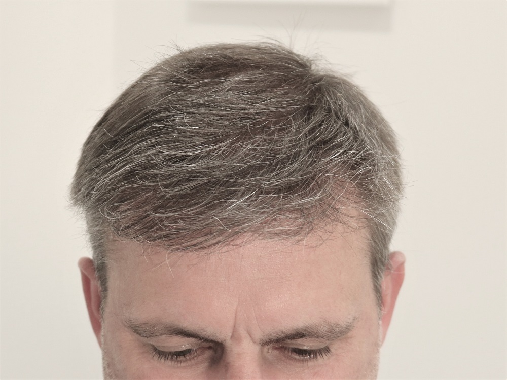 /foren/transplant/index.php/fa/53608/0/