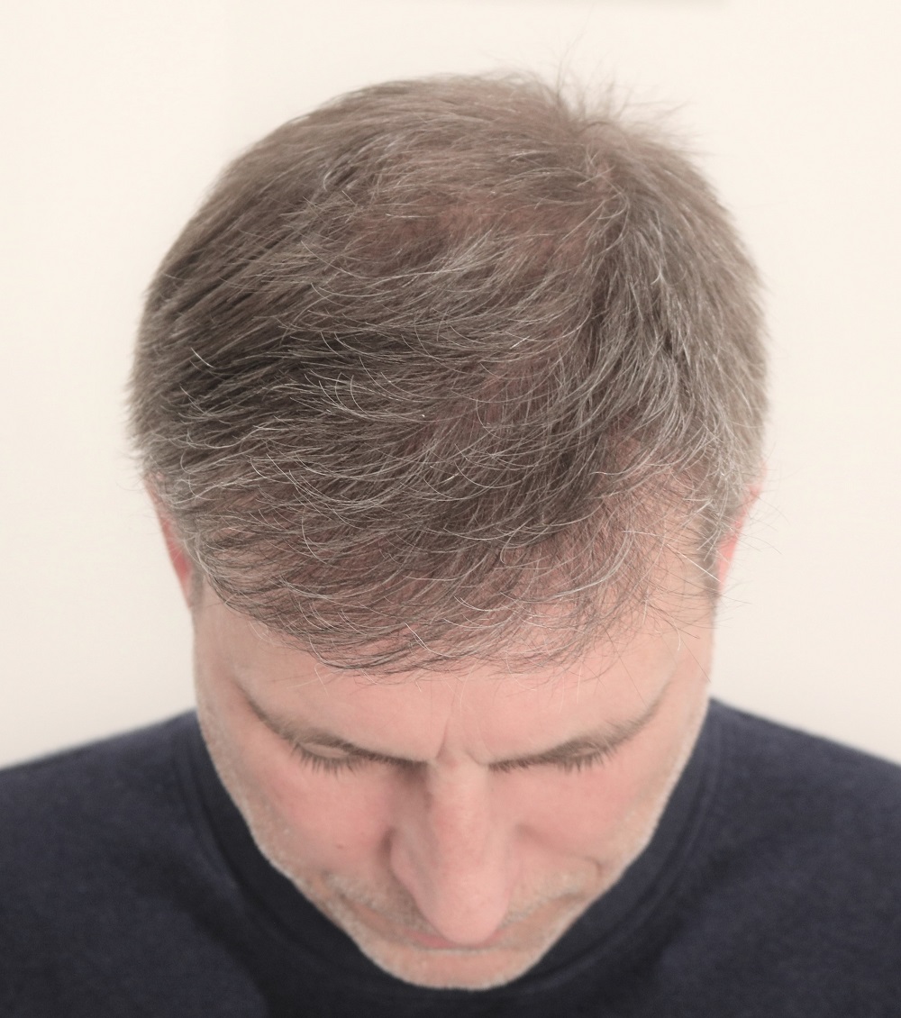 /foren/transplant/index.php/fa/53609/0/