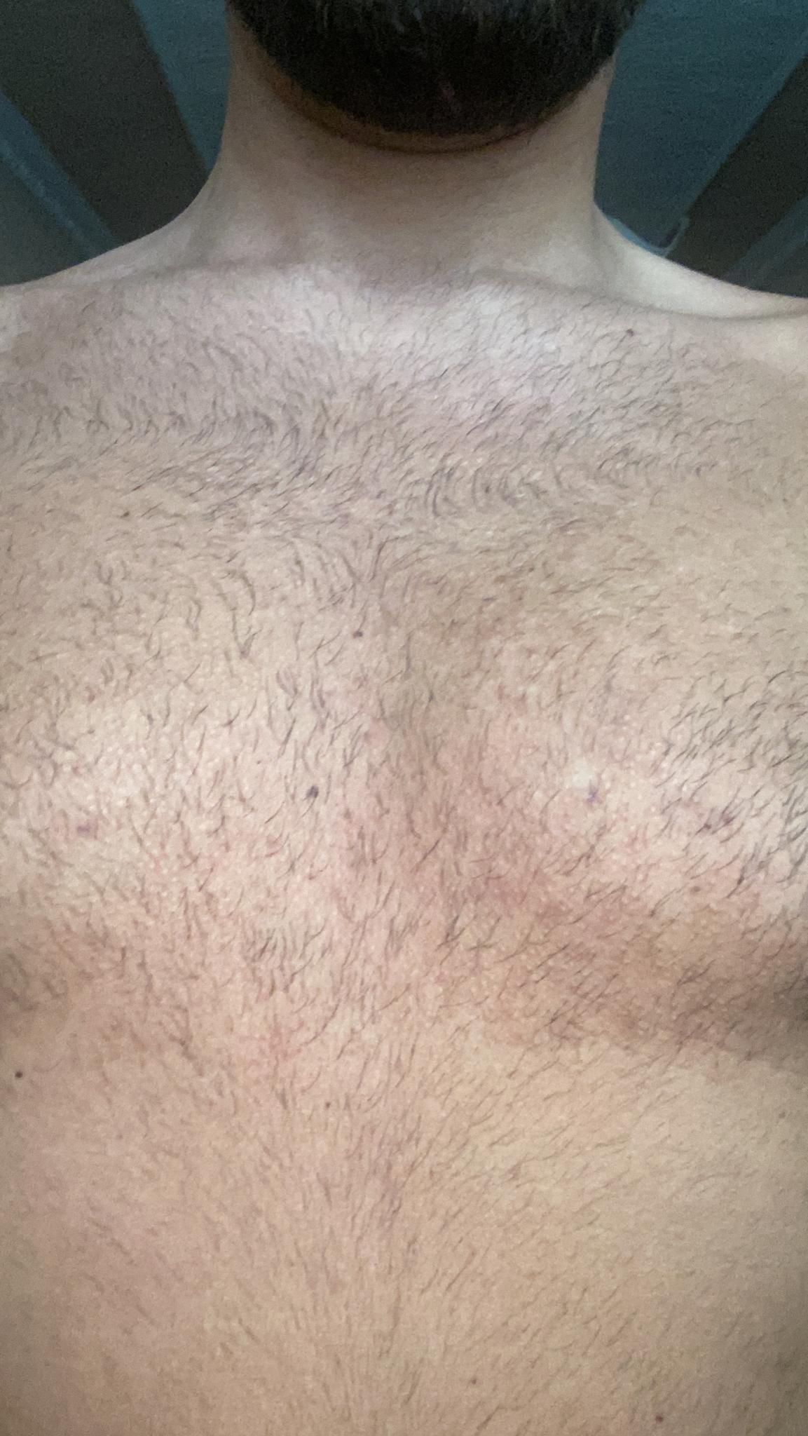 /foren/transplant/index.php/fa/53650/0/