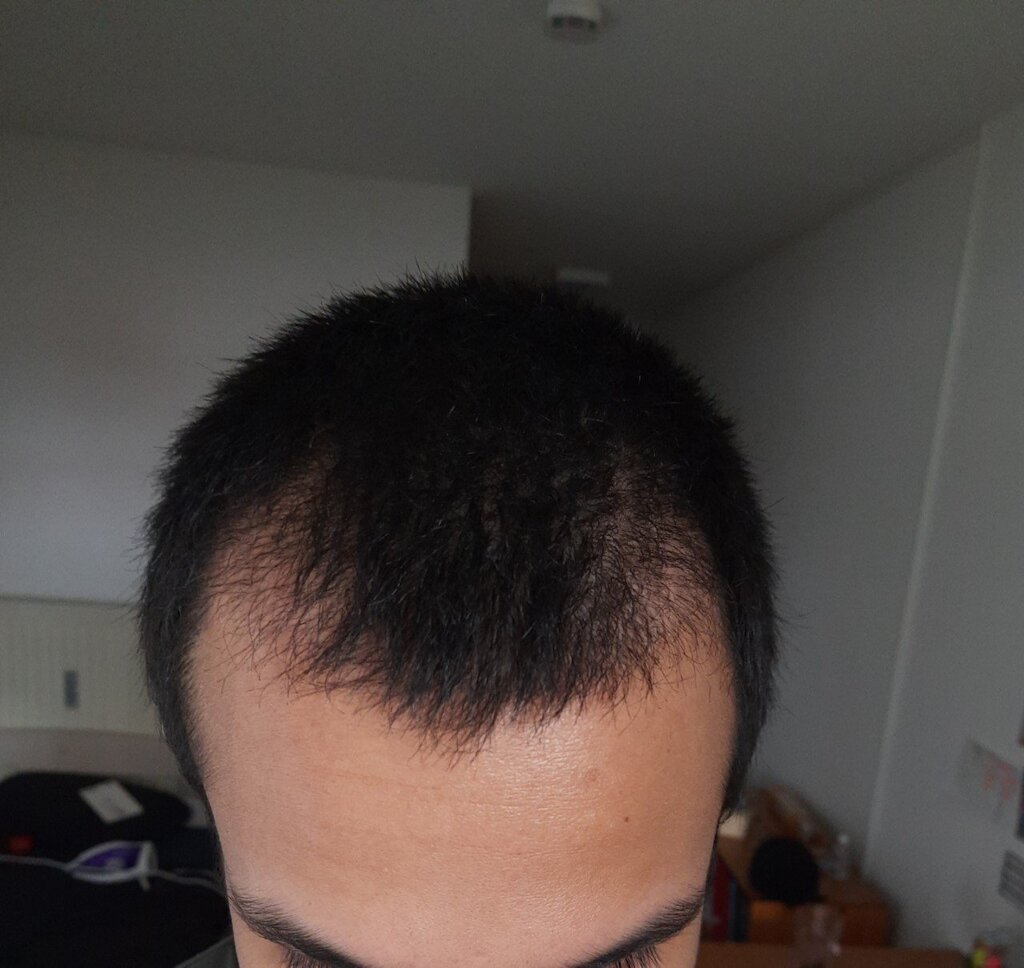 /foren/transplant/index.php/fa/53695/0/