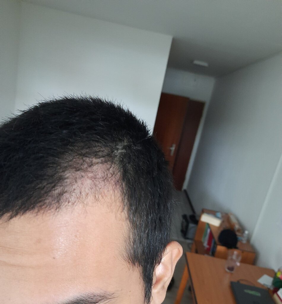 /foren/transplant/index.php/fa/53696/0/