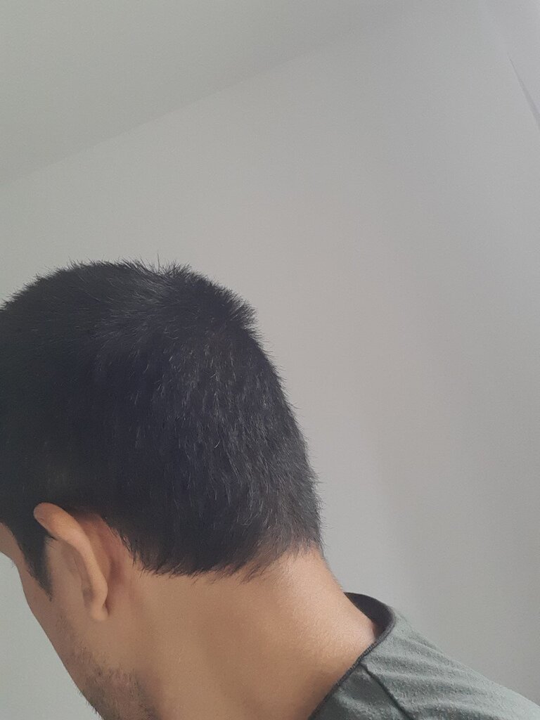 /foren/transplant/index.php/fa/53697/0/