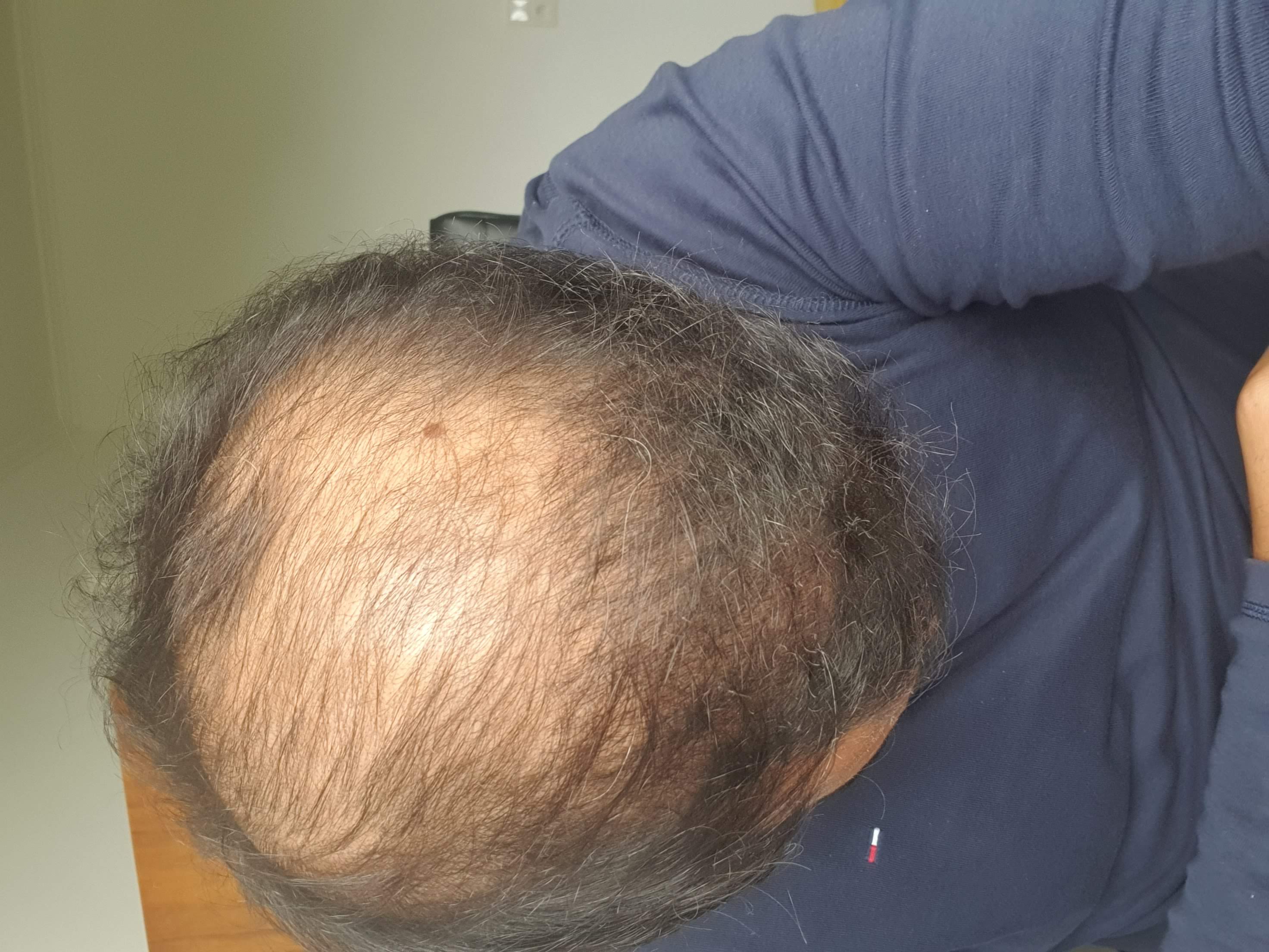 /foren/transplant/index.php/fa/53706/0/