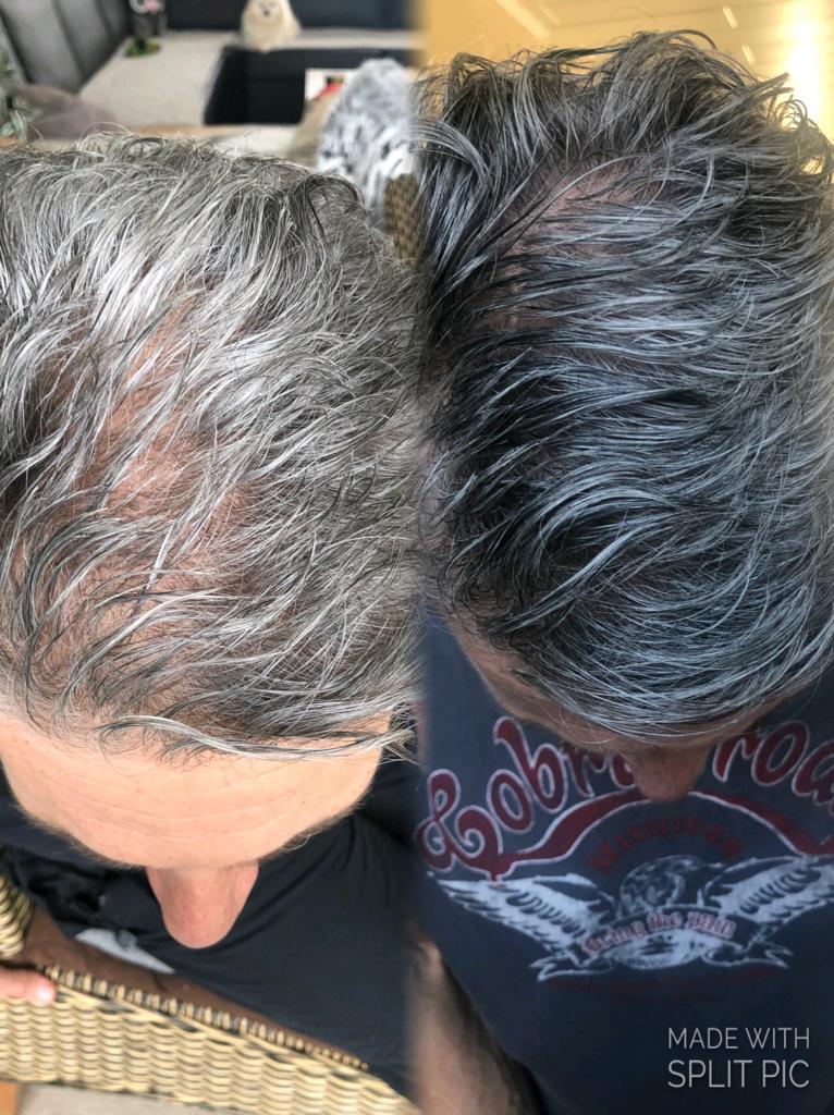 /foren/transplant/index.php/fa/53718/0/