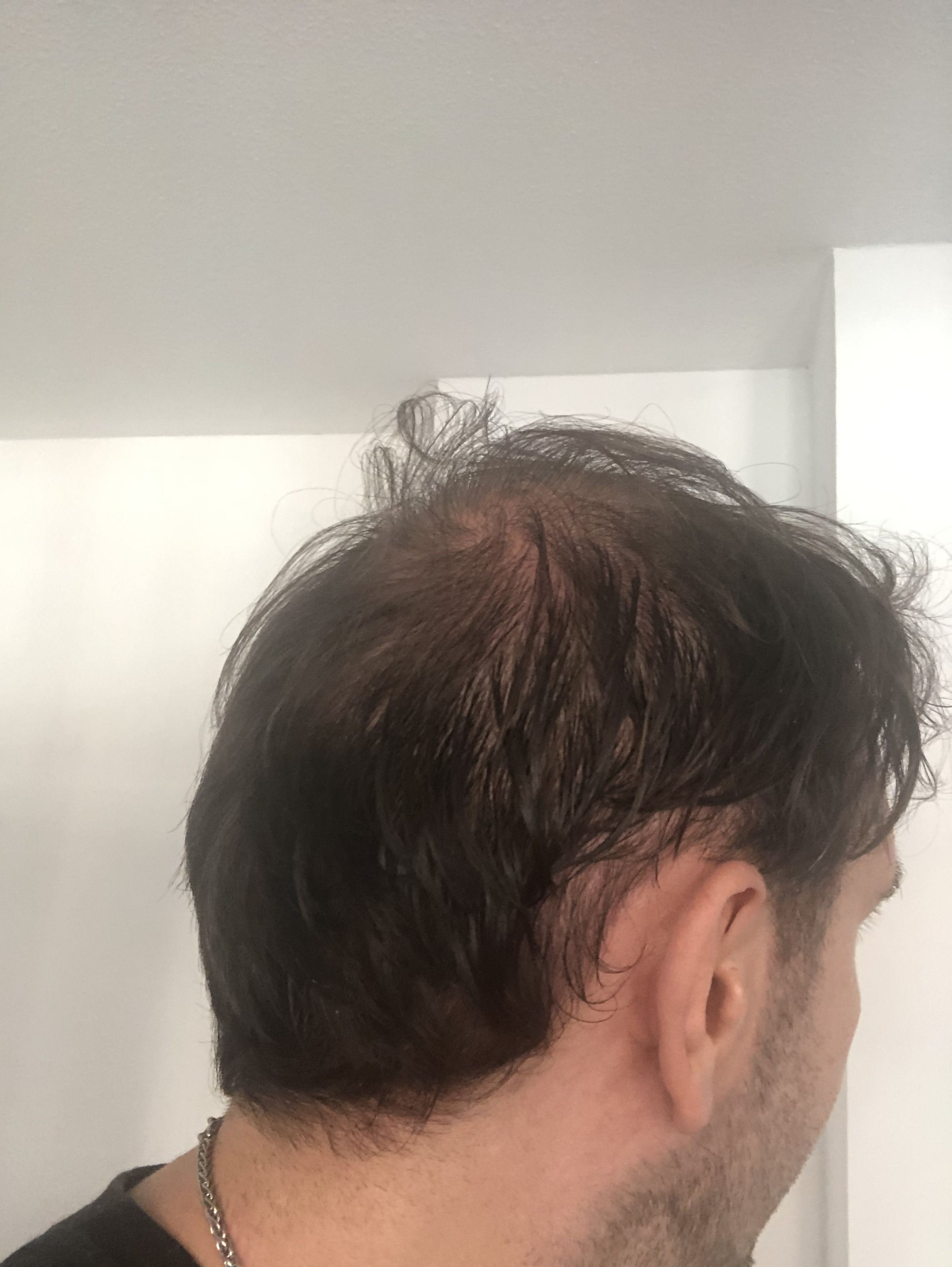 /foren/transplant/index.php/fa/53730/0/