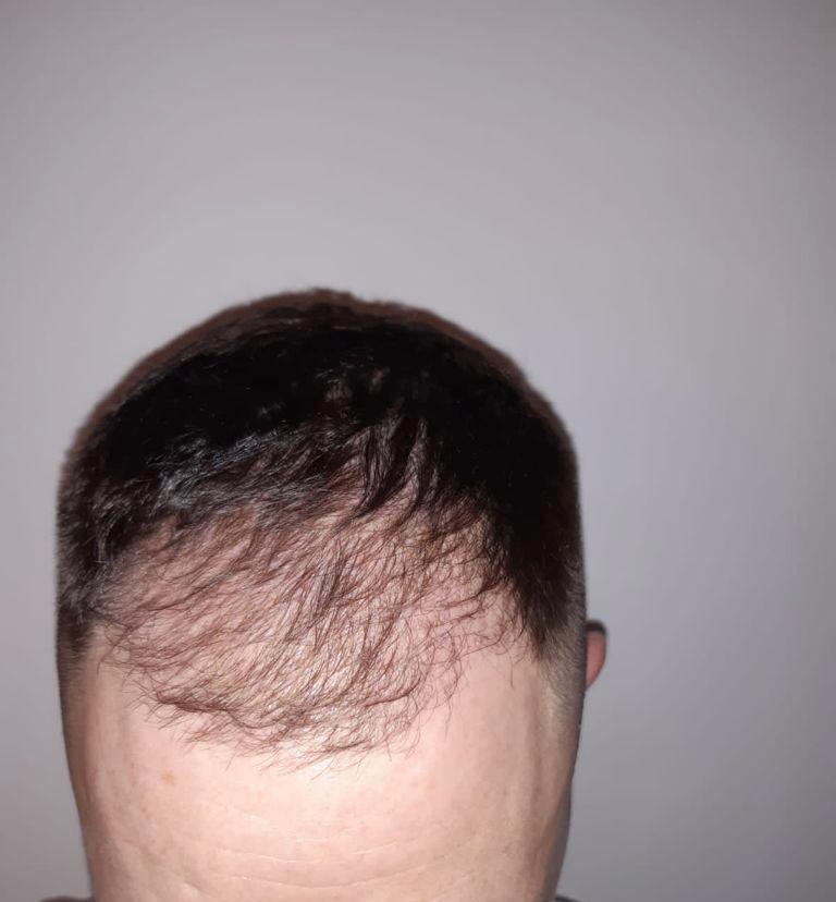 /foren/transplant/index.php/fa/53732/0/