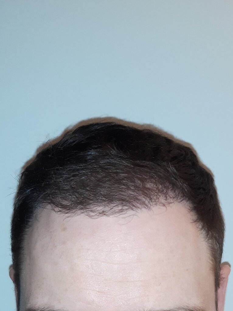 /foren/transplant/index.php/fa/53734/0/