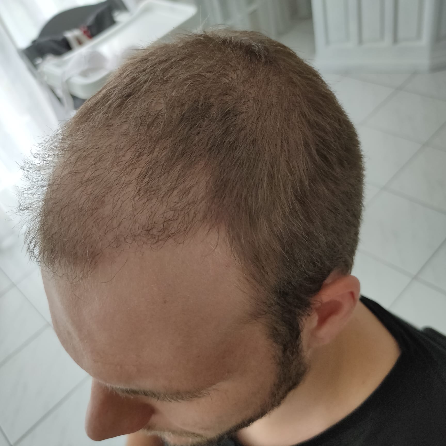 /foren/transplant/index.php/fa/53736/0/