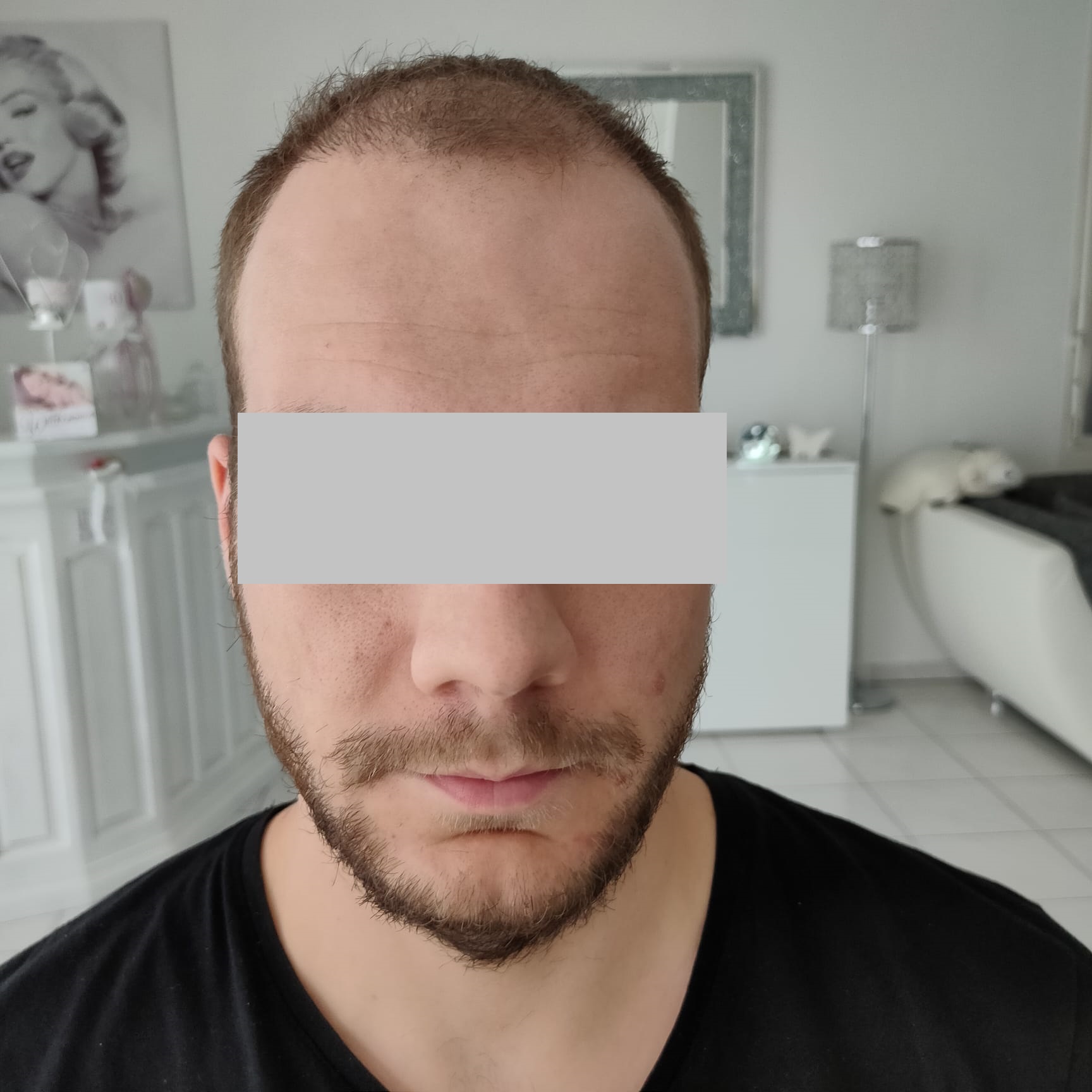 /foren/transplant/index.php/fa/53737/0/