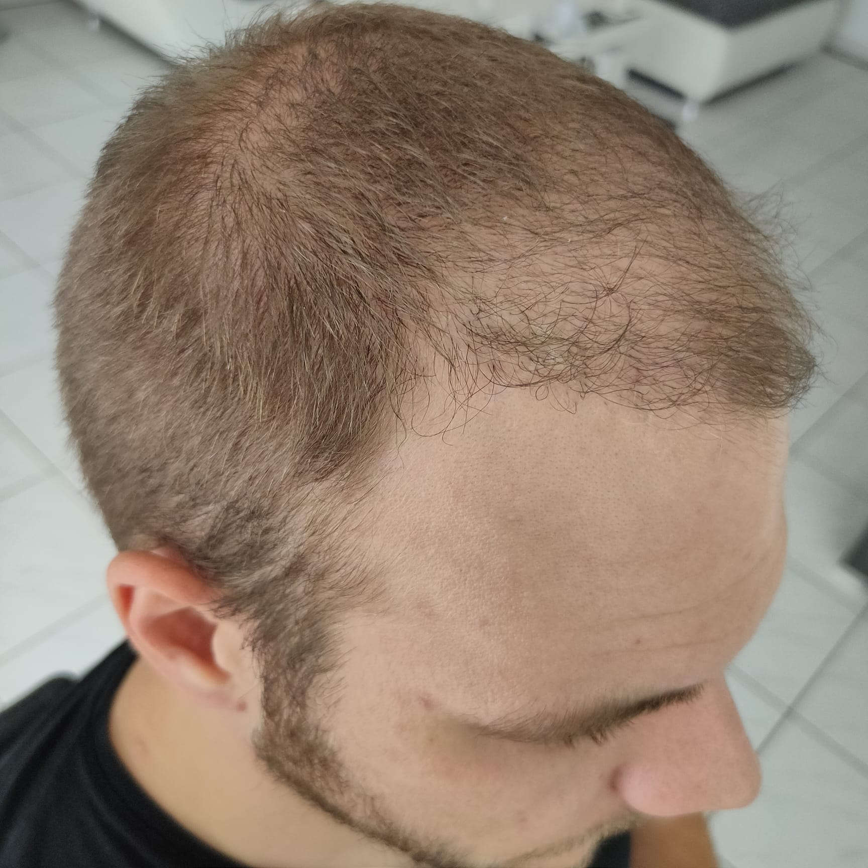 /foren/transplant/index.php/fa/53738/0/