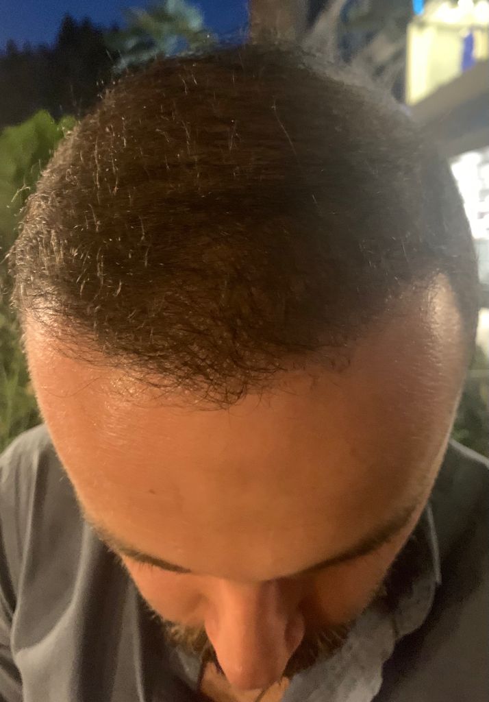 /foren/transplant/index.php/fa/53794/0/