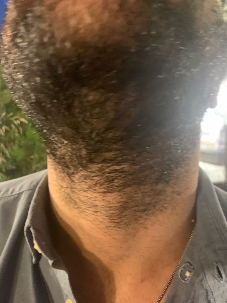 /foren/transplant/index.php/fa/53795/0/