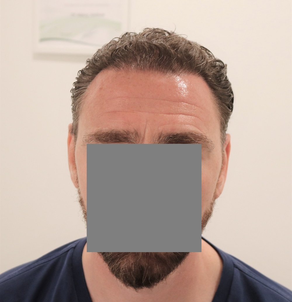 /foren/transplant/index.php/fa/53798/0/