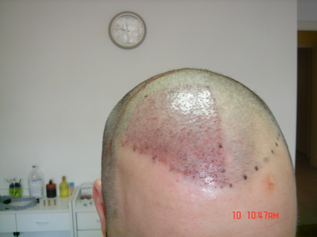 index.php/fa/5380/0/