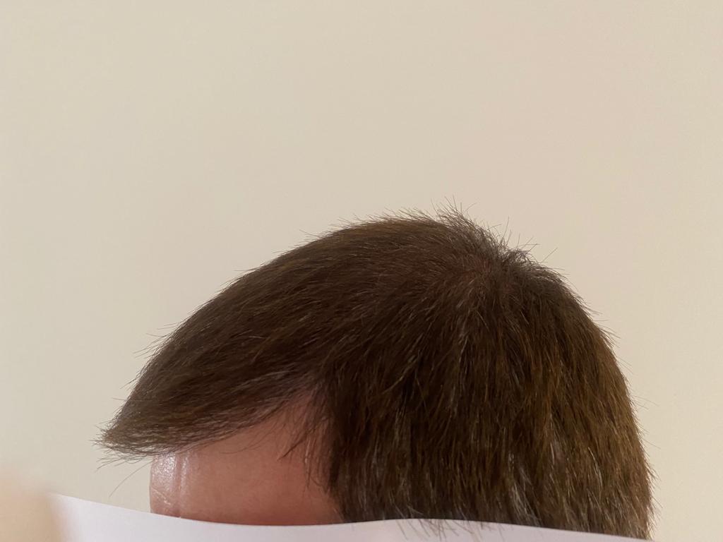 /foren/transplant/index.php/fa/53800/0/