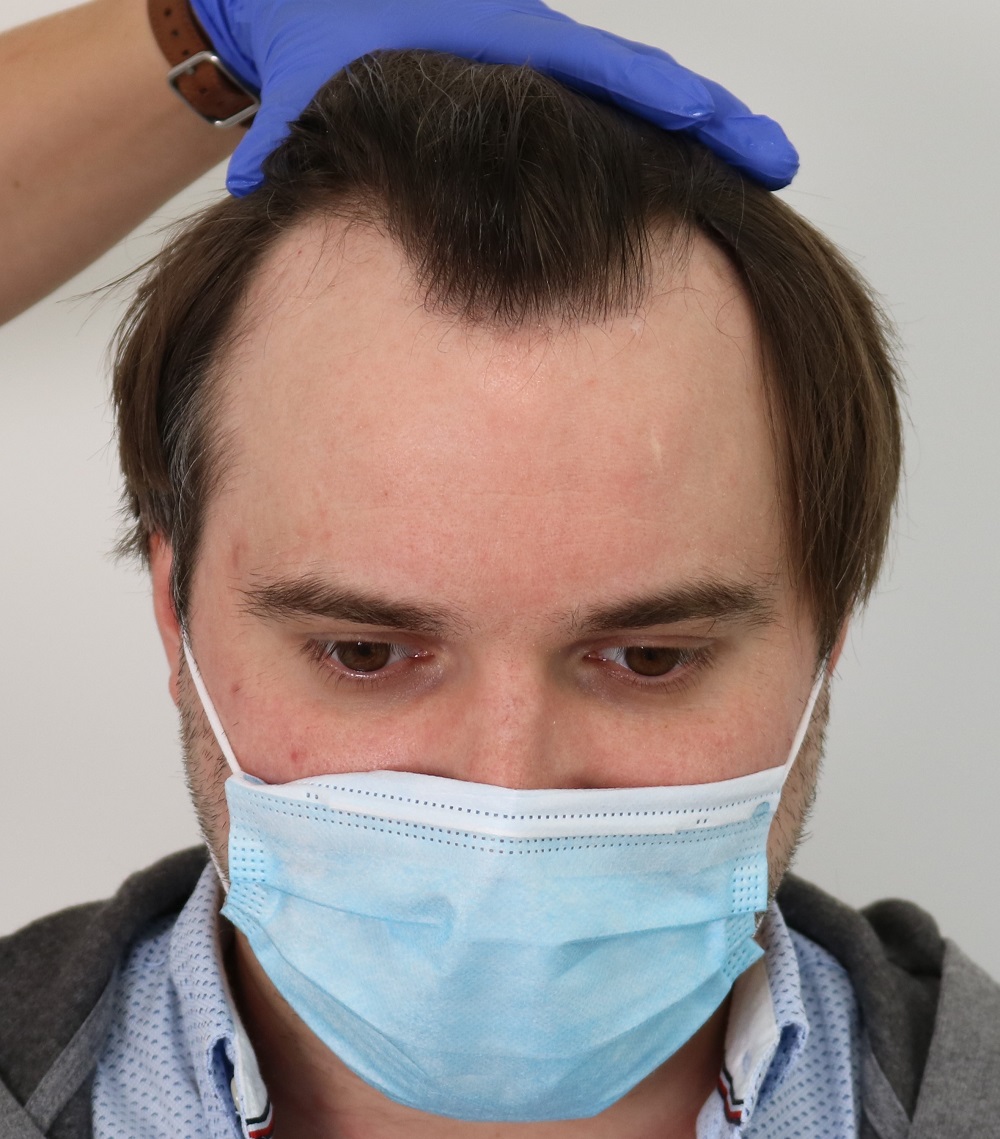 /foren/transplant/index.php/fa/53812/0/