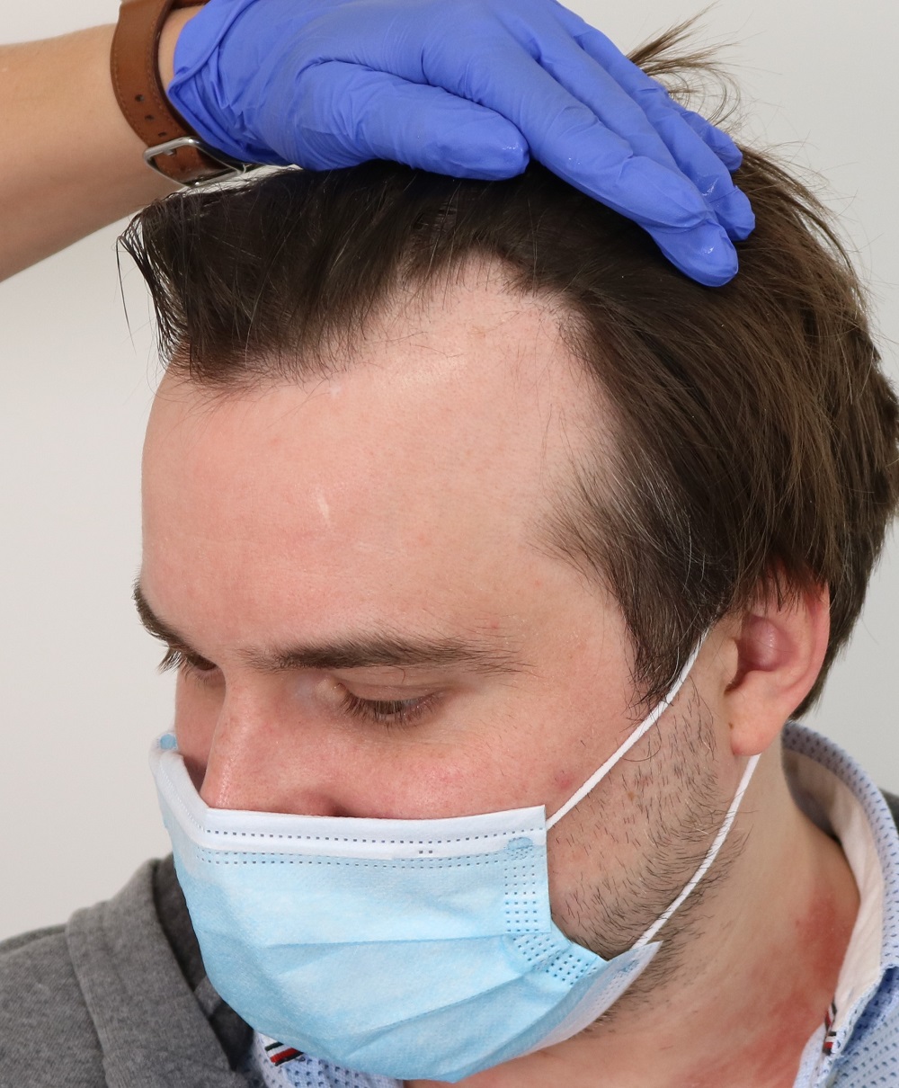 /foren/transplant/index.php/fa/53814/0/