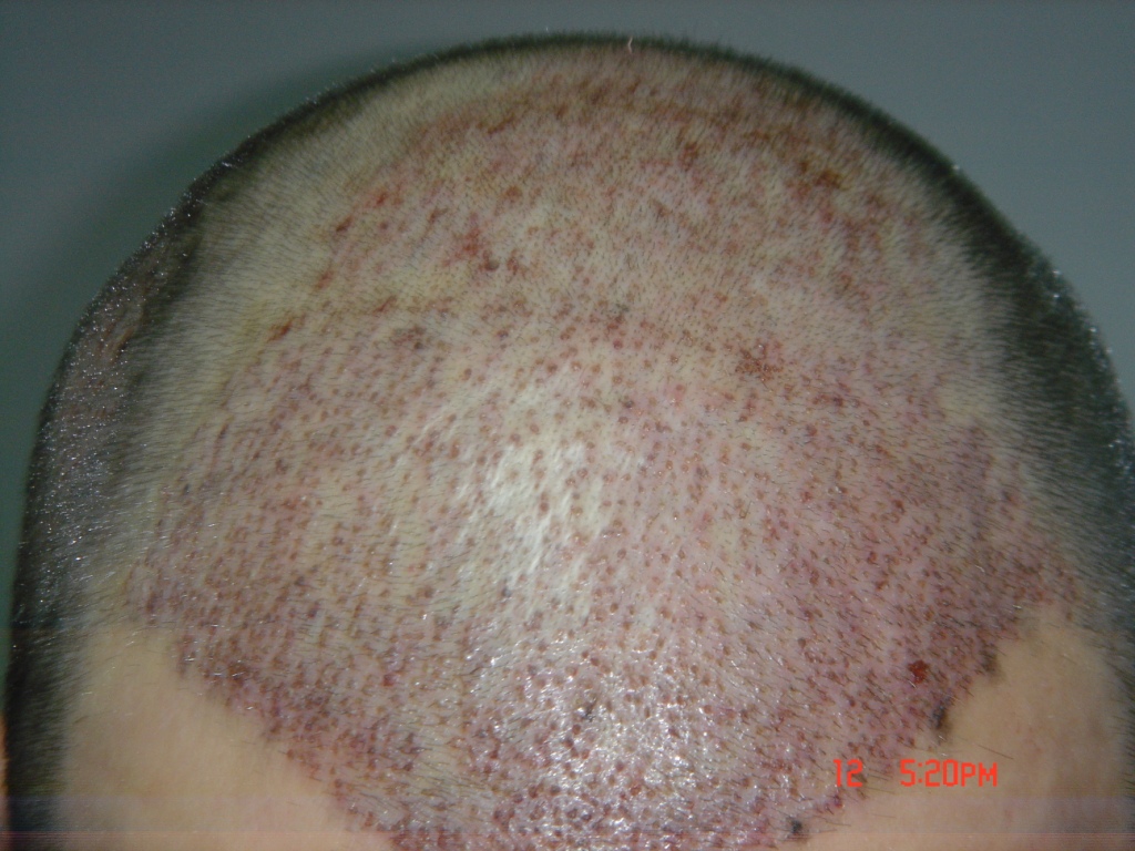 index.php/fa/5382/0/