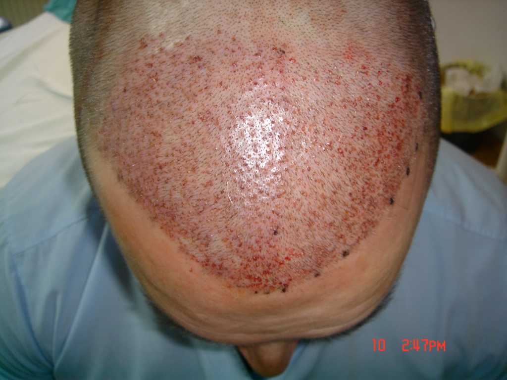 index.php/fa/5383/0/