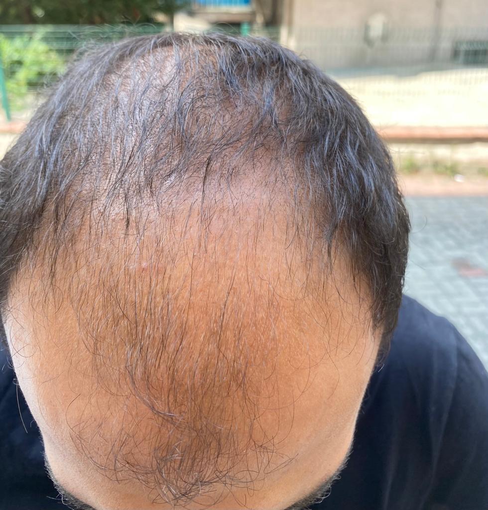 /foren/transplant/index.php/fa/53840/0/