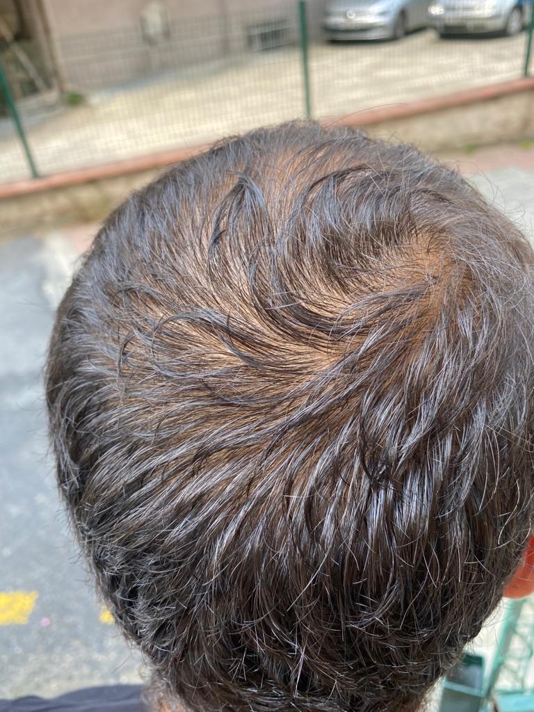 /foren/transplant/index.php/fa/53844/0/