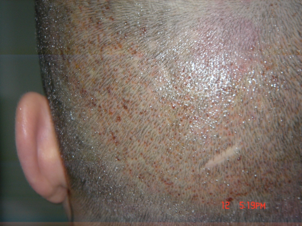 index.php/fa/5385/0/