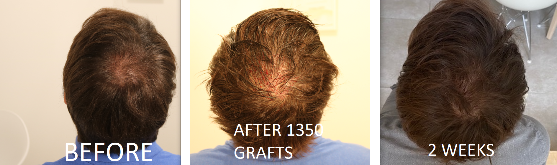 /foren/transplant/index.php/fa/53854/0/