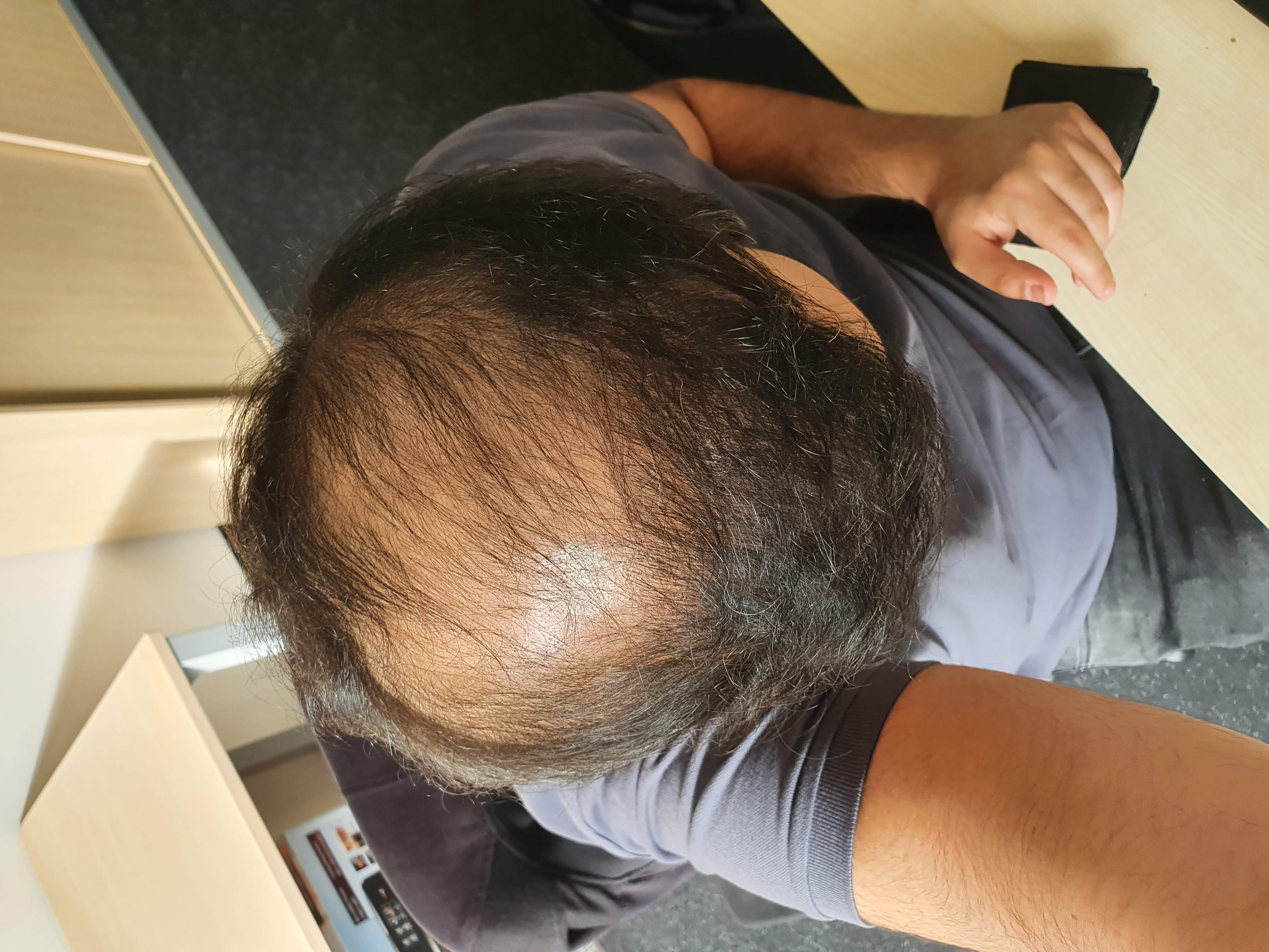 /foren/transplant/index.php/fa/53858/0/