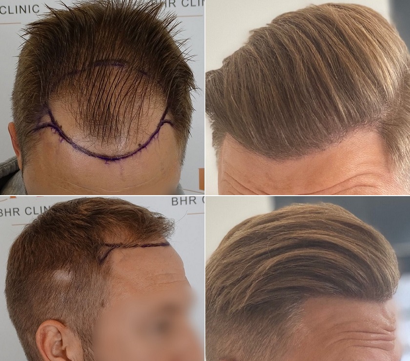 /foren/transplant/index.php/fa/53860/0/