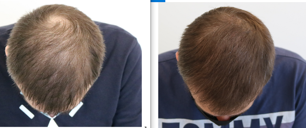 /foren/transplant/index.php/fa/53987/0/