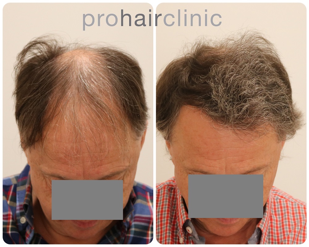 /foren/transplant/index.php/fa/53996/0/