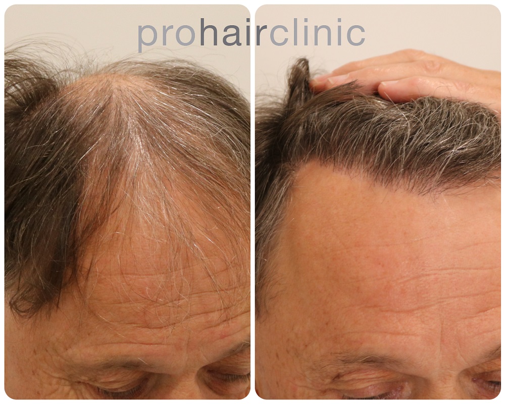 /foren/transplant/index.php/fa/53999/0/