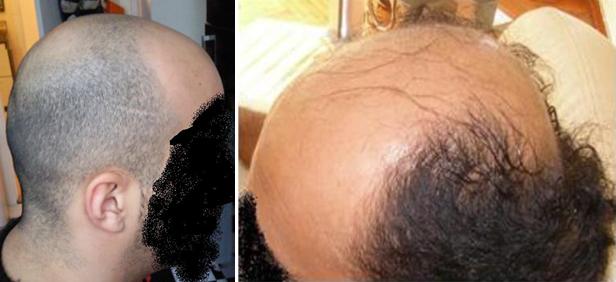 index.php/fa/5402/0/