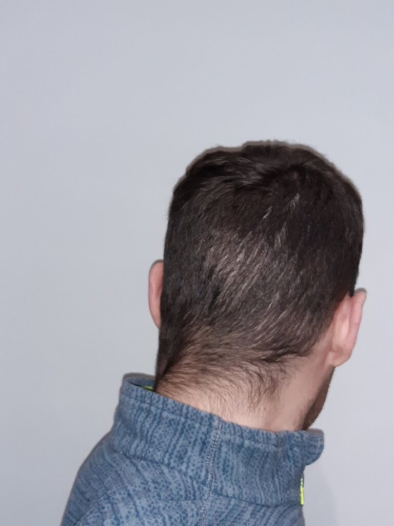 /foren/transplant/index.php/fa/54021/0/