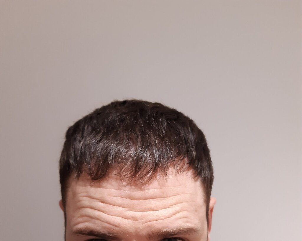 /foren/transplant/index.php/fa/54022/0/