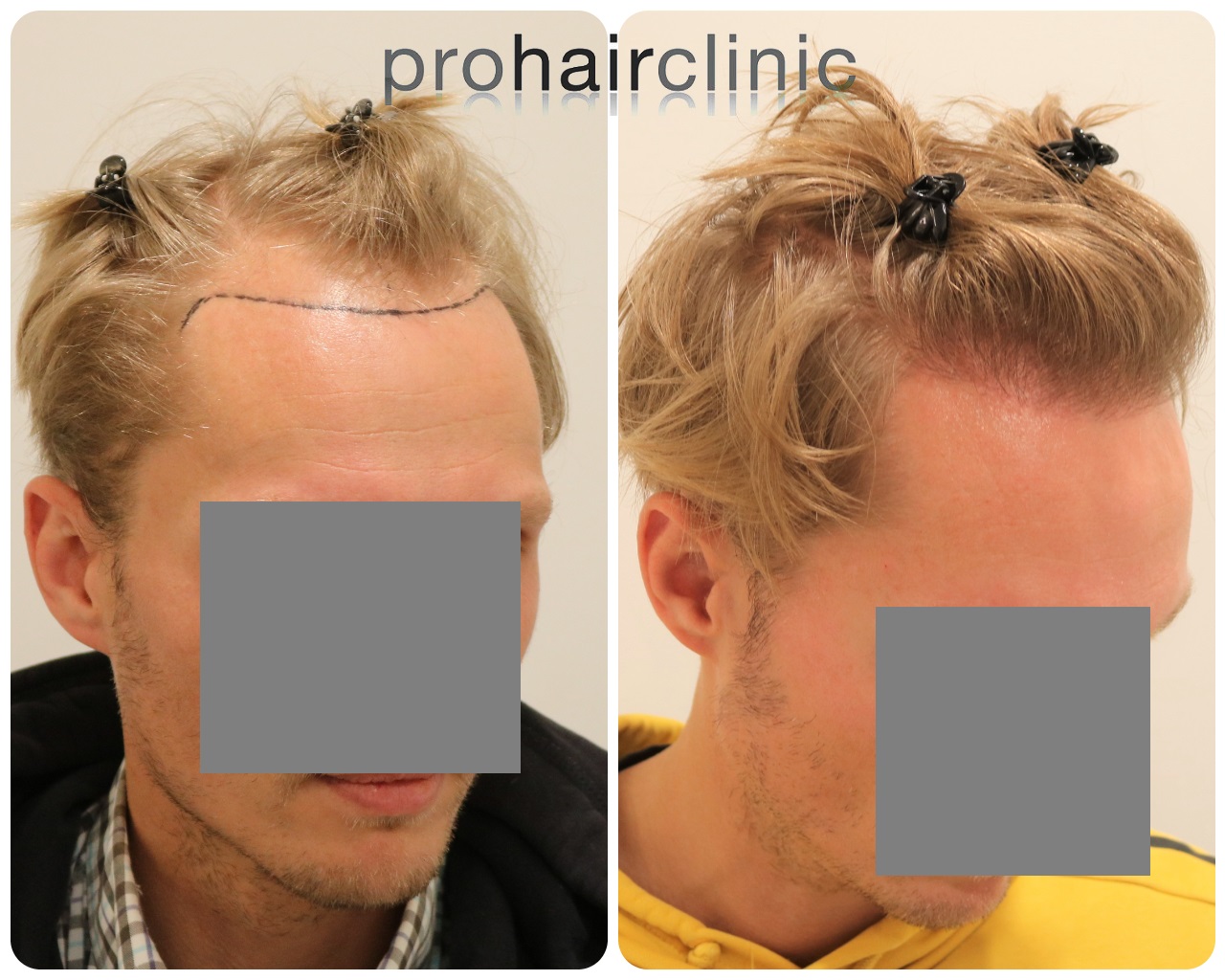 /foren/transplant/index.php/fa/54048/0/