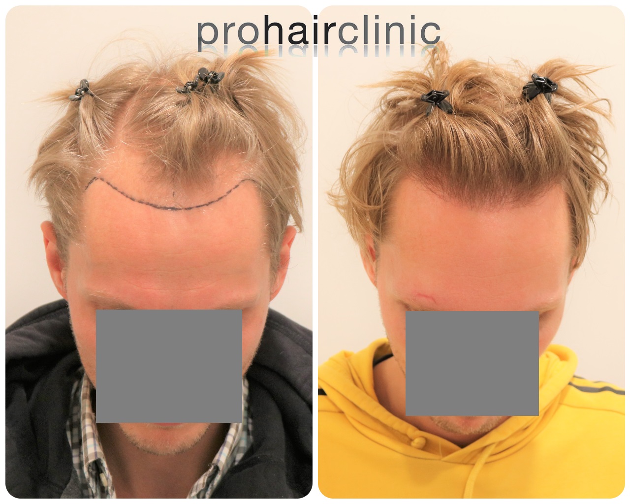 /foren/transplant/index.php/fa/54049/0/